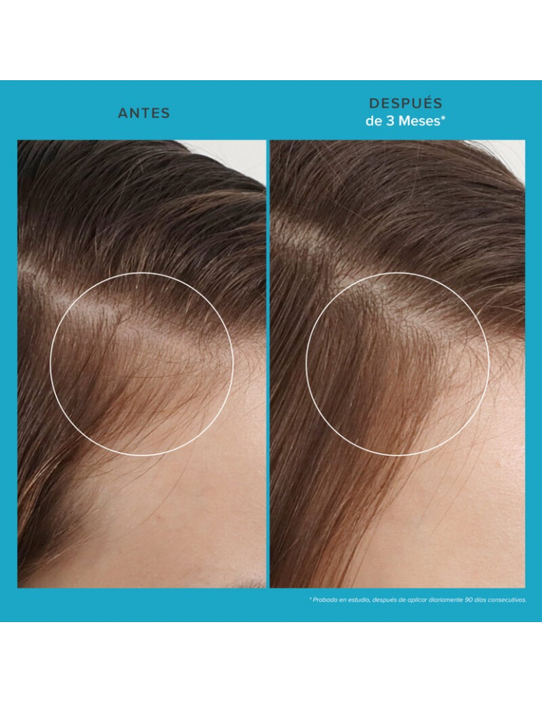 Living Proof Scalp Care Revitalizing Treatment  | Tratamiento densificador para pelo fino