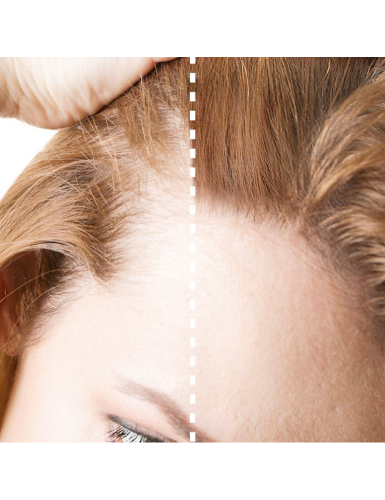 Nanofibers MARRÓN |  Fibras Capilares con Keratina 25gr + Spray Fijador 100ml